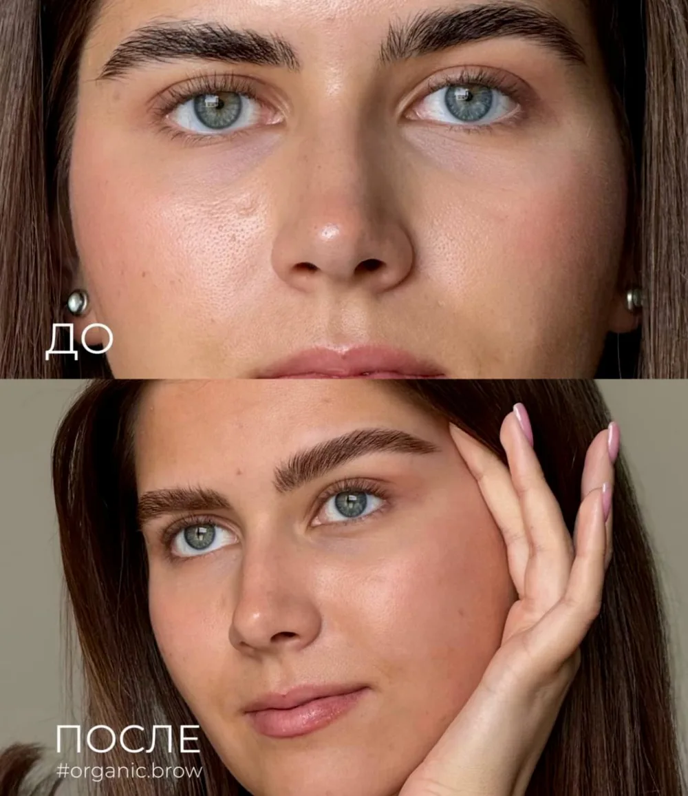 до и после