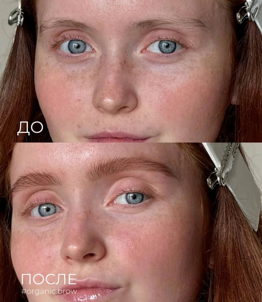 до и после