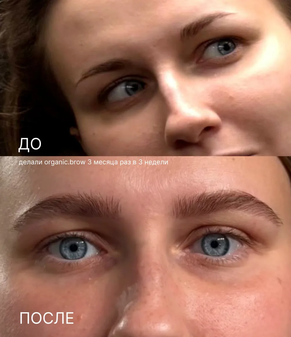до и после
